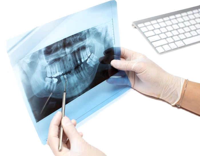 teeth xray background