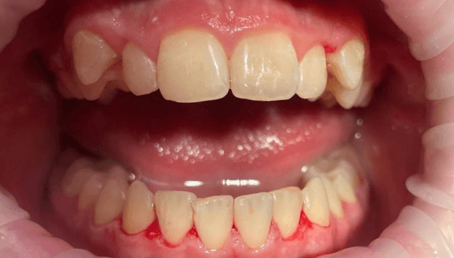 children dentistry after