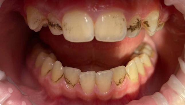 children dentistry before