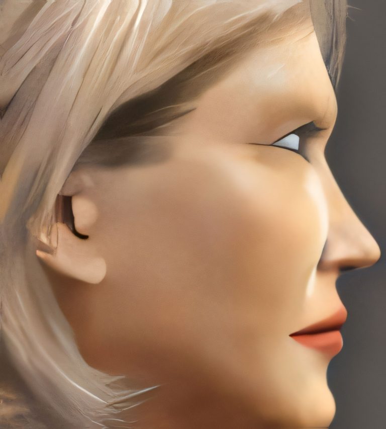 no jaw bone atrophy with implants