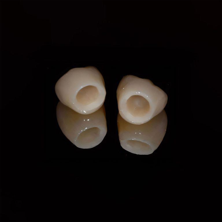 ceramic crown