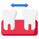 diastema