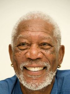 freeman after veneers
