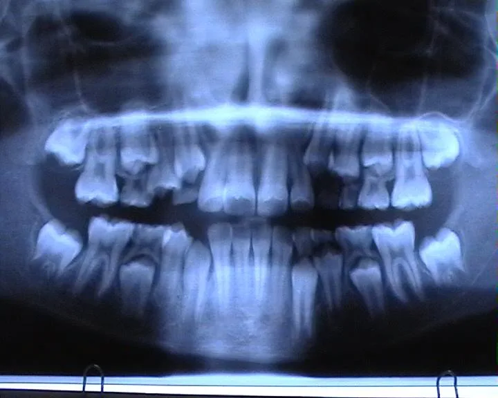 orthopantomogram