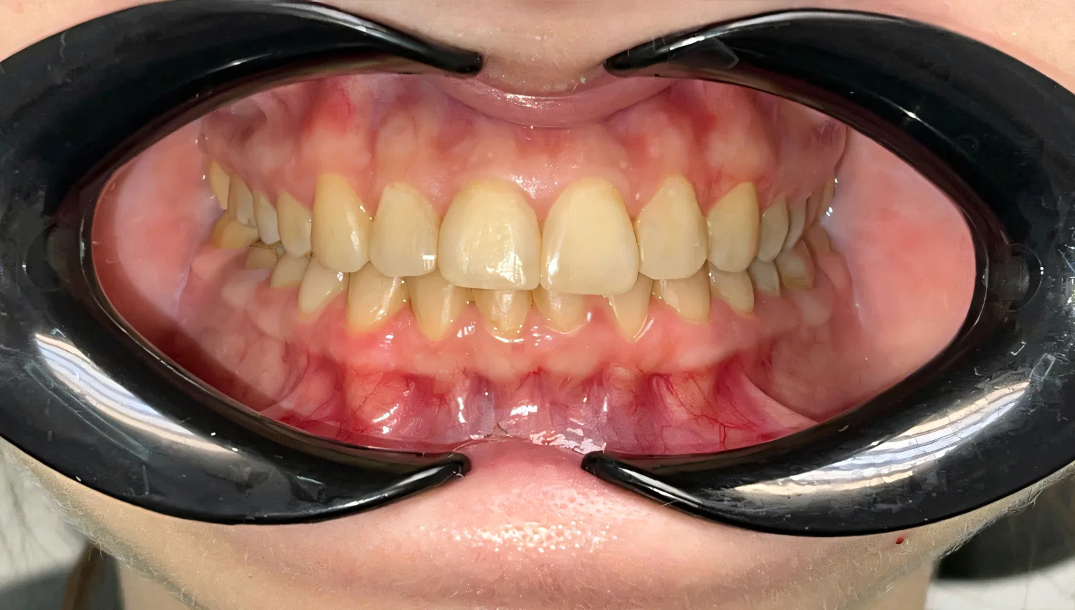 orthopedia after