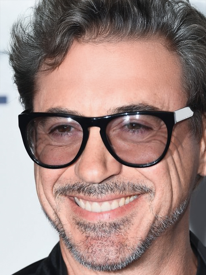 robert downey after veneers