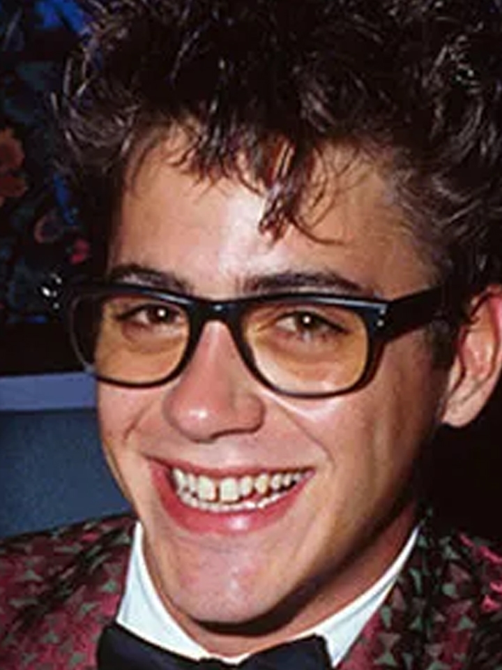 robert downey before veneers