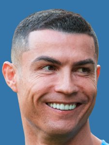 ronaldo after veneers