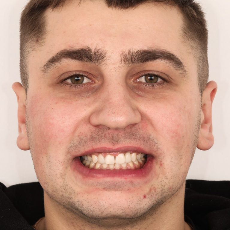 stepanchuk dmytro portrait after 1