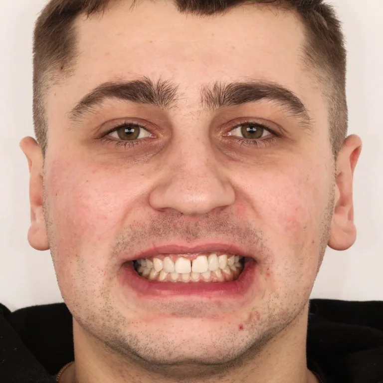 stepanchuk dmytro portrait after 1